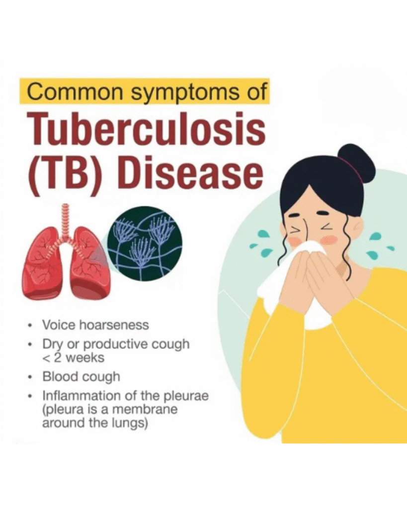 TB treatment consultation in Delhi